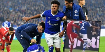 Habrá reencuentro entre James Rodríguez y el jugador al que, sin culpa, lesionó