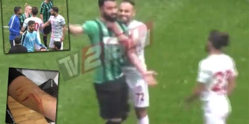 ¡Salió al campo de juego con una cuchilla y agredió a sus rivales!