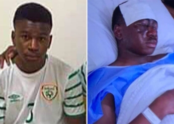 Atacaron con ácido a joven promesa del fútbol irlandés