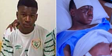 Atacaron con ácido a joven promesa del fútbol irlandés