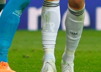 Use las espinilleras para fútbol en forma correcta y evite lesiones