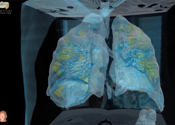 Video en 3D revela el ataque que le hace el coronavirus a los pulmones