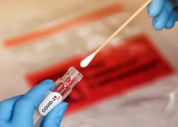 Esto costaría la prueba del coronavirus COVID-19 en Colombia