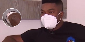 Estado de salud de Félix Micolta tras ataque con arma de fuego