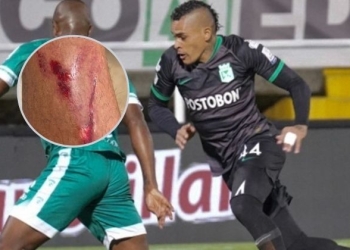 La fuerte imagen que publicó Jonatan Álvez después de Equidad vs. Nacional