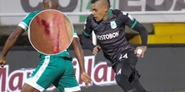 La fuerte imagen que publicó Jonatan Álvez después de Equidad vs. Nacional