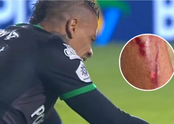 El momento del golpe que lastimó a Jonatan Álvez en La Equidad vs. Atlético Nacional
