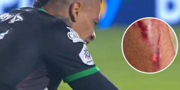 El momento del golpe que lastimó a Jonatan Álvez en La Equidad vs. Atlético Nacional