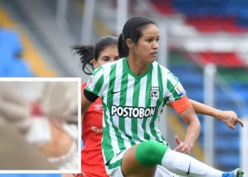 Polémica en el fútbol femenino tras puñetazo que provocó 5 puntos en jugadora de América