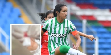 Polémica en el fútbol femenino tras puñetazo que provocó 5 puntos en jugadora de América