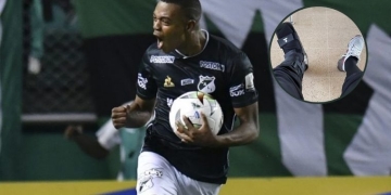 Lesión de Harold Preciado y el tiempo que estaría fuera de las canchas