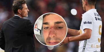 Dinenno tras la semifinal en la Liga MX: «Fractura de nariz y 7 puntos»