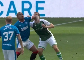 Alfredo Morelos: Codazo y roja directa en Escocia