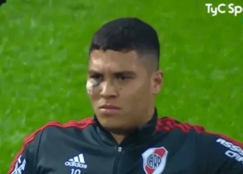 ¿¡Qué le pasó a Juanfer Quintero en el ojo!?