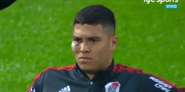 ¿¡Qué le pasó a Juanfer Quintero en el ojo!?