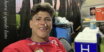 El nuevo aspecto de Jorge Carrascal tras un golpe en el rostro