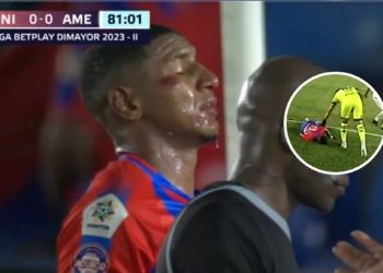 Así quedó Juan Camilo Angulo tras un fuerte choque de Daniel Mosquera