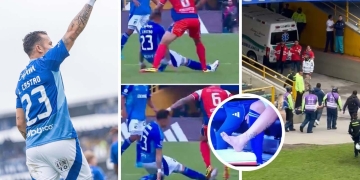 millonarios leo castro lesion liga betplay