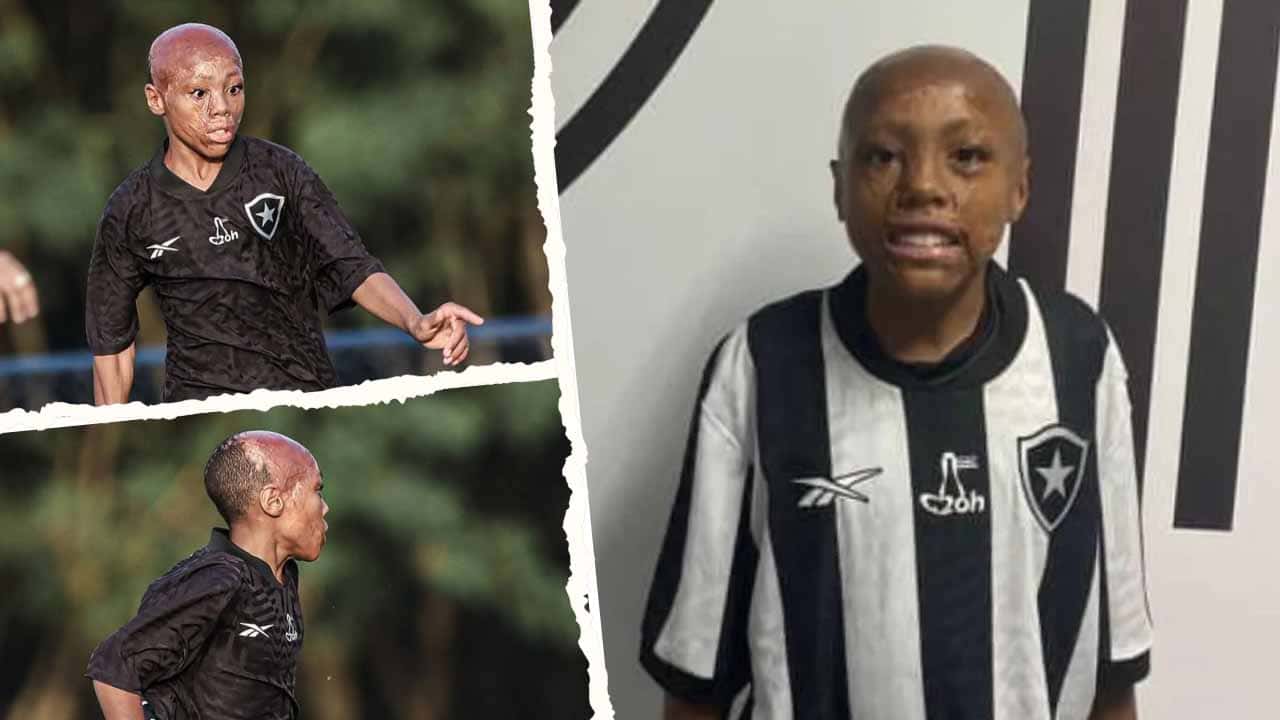 bernardo lopes historia superacion botafogo