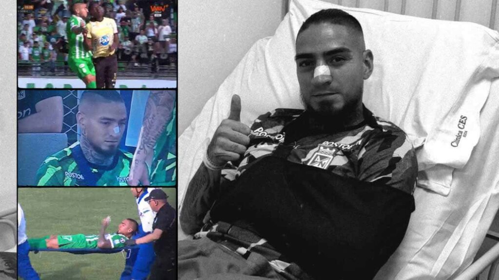 atletico nacional chicho arango lesion aguilas liga betplay