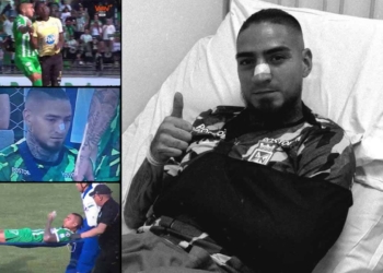 atletico nacional chicho arango lesion aguilas liga betplay