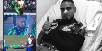 atletico nacional chicho arango lesion aguilas liga betplay