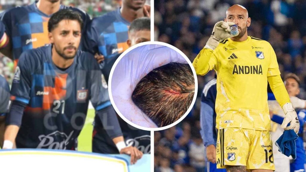 millonarios boyaca chico diego novoa pimentel liga betplay