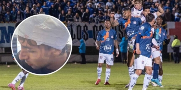 millonarios boyaca chico jacobo pimentel versiones