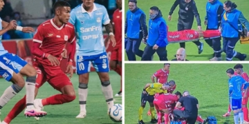 america de cali macara lesion mateo castillo sudamericana